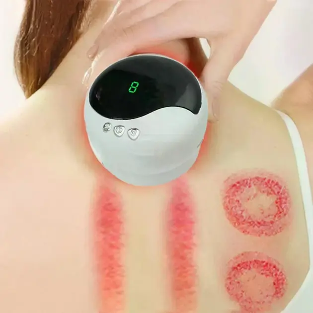 Антицелюлітний вакуумний масажер Intelligent Cupping Massage, акумуляторний ручний масажер для тіла Білий LY-873-White - Зображення 5