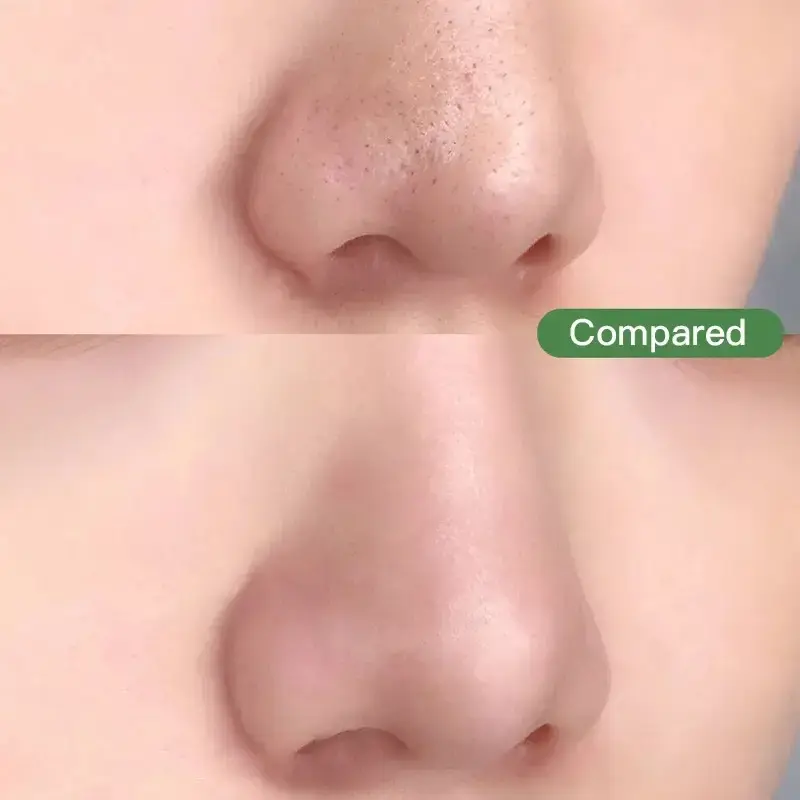 Маска для обличчя з маслом зеленого чаю проти чорних точок акне очищаюча Green Tea крем зволожуючий - Зображення 5