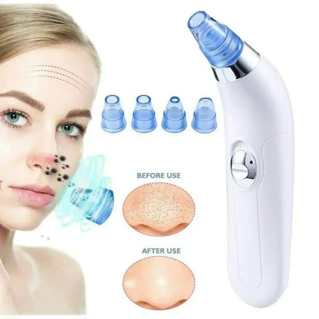 Вакуумний очисник Derma suction DS Vacuum для професійної чистки шкіри та пор обличчя - легкий компактний зручний прилад у використанні + 4 насадки, Білий - Зображення 6