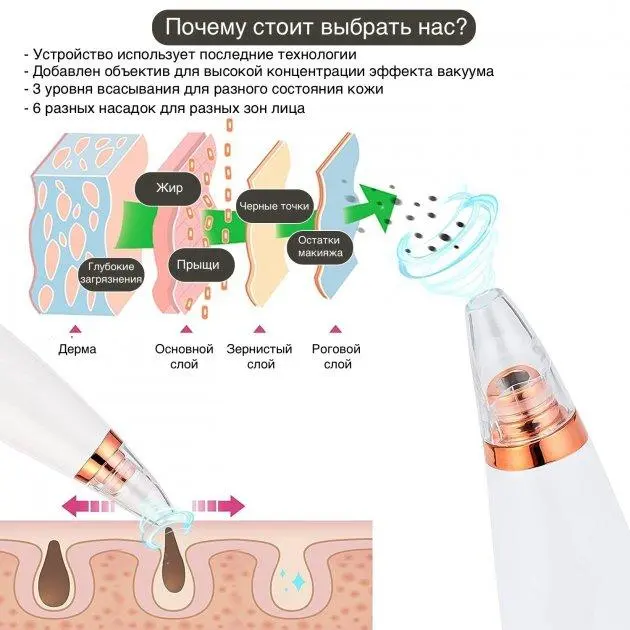 Вакуумний очищувач шкіри та пор Multi-Functional для чищення обличчя - Зображення 4