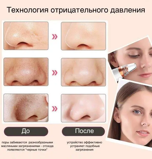Вакуумний очищувач шкіри та пор Multi-Functional для чищення обличчя - Зображення 2